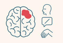 Infografika symbolizująca udar oraz jego objawy - bezwład, osuwająca się twarz i brak możliwości mowy