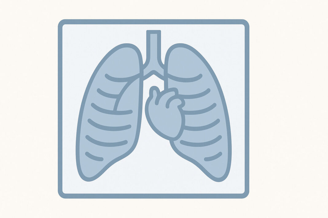 rtg-pluc Ilustracja graficzna rtg klatki piersiowej i płuc