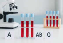Probówki z krwią i oznaczeniami grup krwi: A, AB, 0