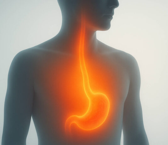 Ilustracja palenia w przełyku i żołądku, zgaga