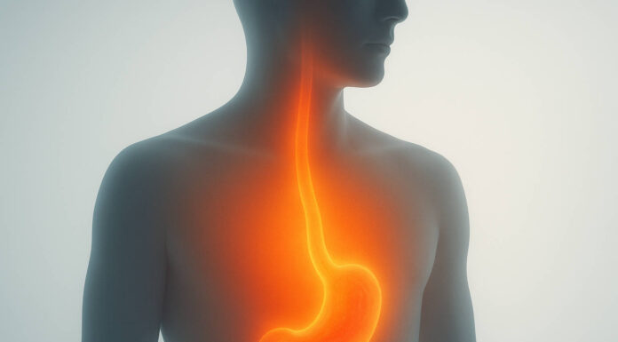 Ilustracja palenia w przełyku i żołądku, zgaga