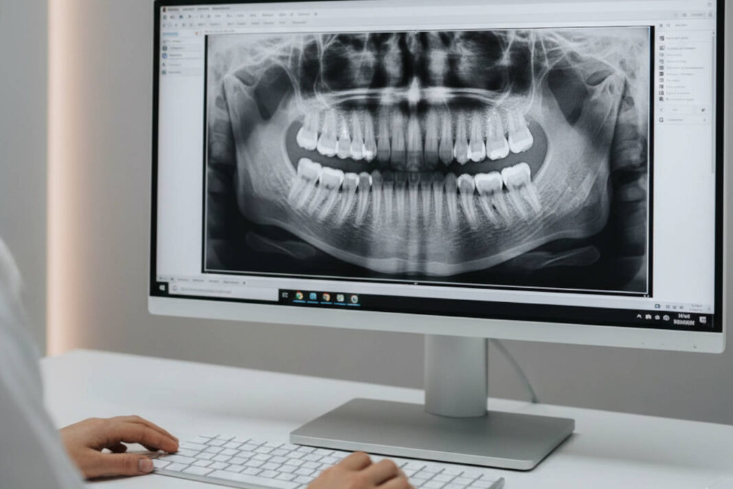 Stomatolog przeglądający na komputerze pantomogram zębów