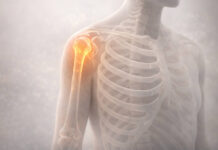 Półprzezroczysta sylwetka edukacyjna z układem kostnym oraz widoczny ból kości w okolicach barku