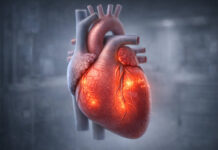 Mięsień serca (grafika 3d) z objawami zapalenia