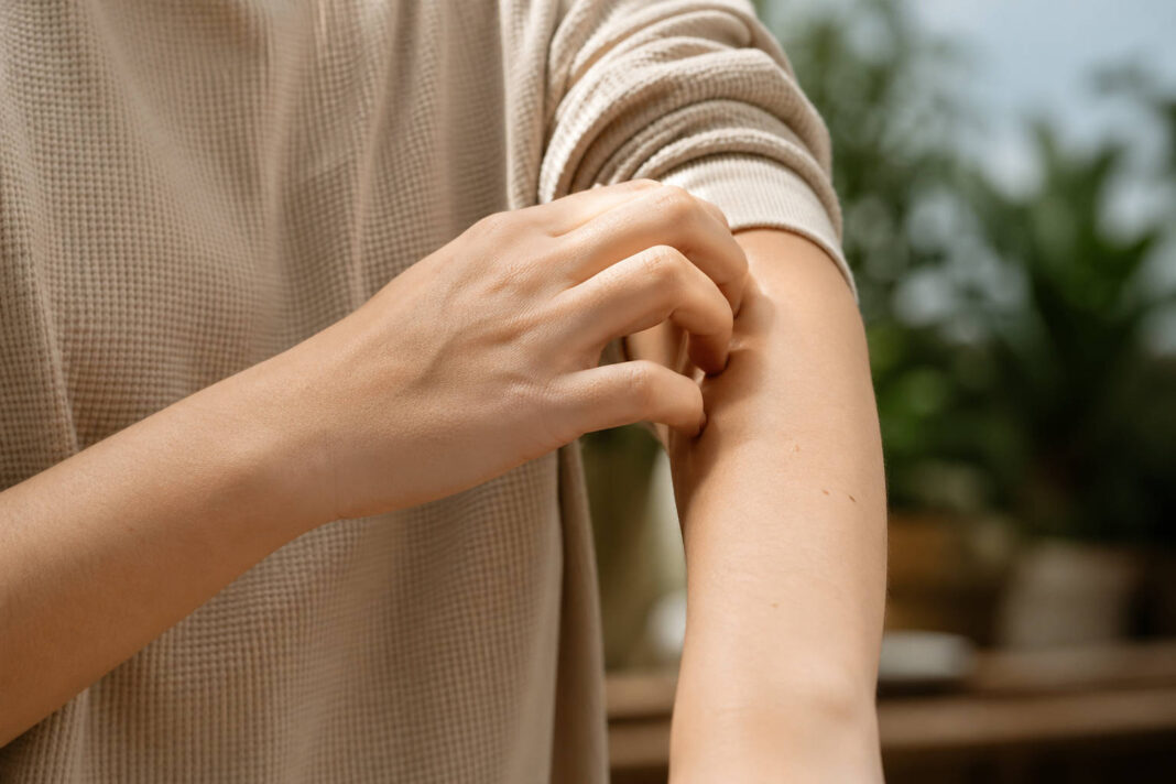 Mężczyzna drapiący się po przedramieniu - skin picking