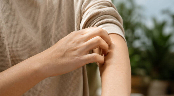 Skin picking – problem dermatologiczny czy psychologiczny? Mężczyzna drapiący się po przedramieniu - skin picking