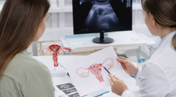 Endometrioza – objawy, rozpoznanie i sposoby diagnozy Lekarz tłumacząca wyniki badania na endometriozę pacjentce